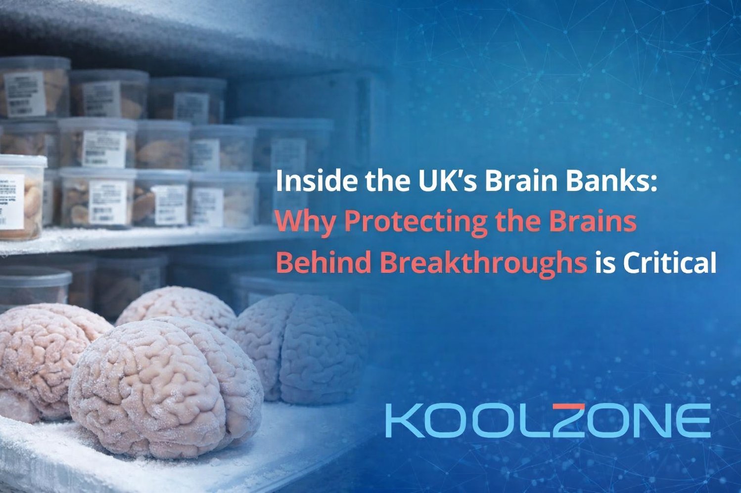 Why Protecting “Brain Banks” is Critical for Scientific Insight.